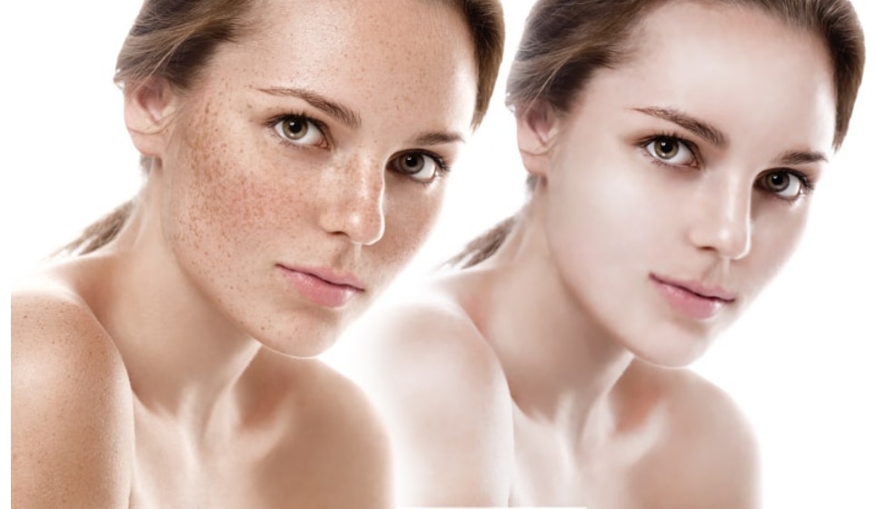 피부 보정 전후 비교